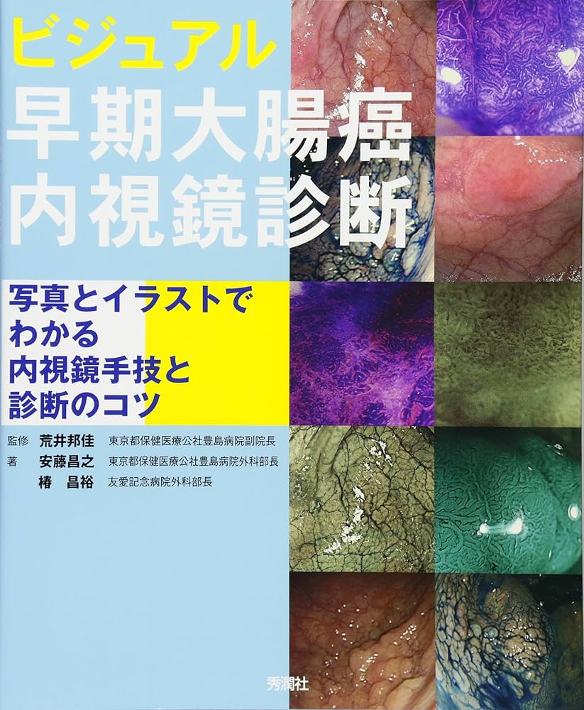 ビジュアル 早期大腸癌内視鏡診断: 写真とイラストでわかる内視